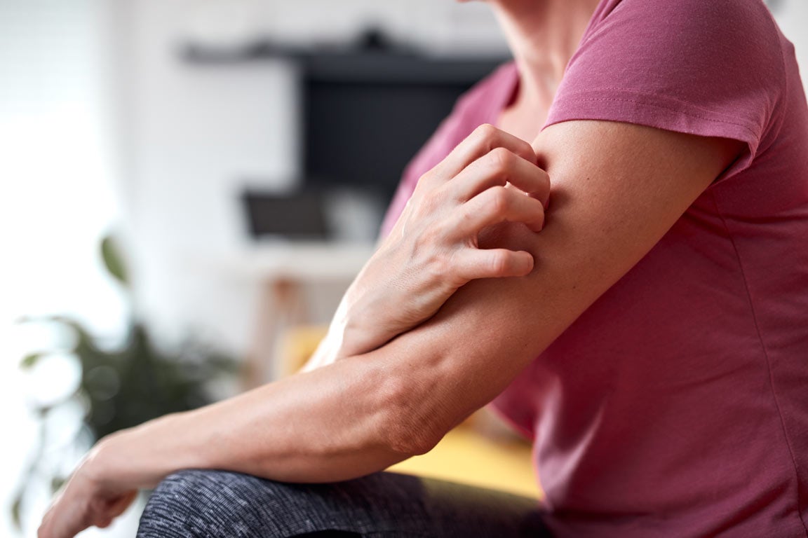 Woman with itchy arms